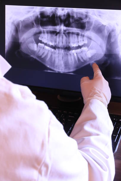 Best Emergency Treatment for Dental Infections or Abscesses in Mvern, AL